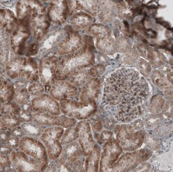 KANK4 Antibody, Novus Biologicals:Antibodies:Primary Antibodies